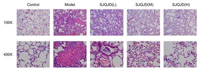 The impact of Sangju Qingjie Decoction on the pulmonary microbiota in the prevention and treatment of chronic obstructive pulmonary disease